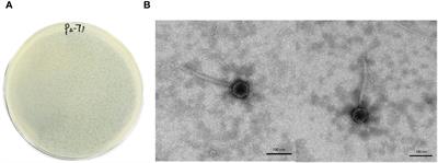 Phage P2-71 against multi-drug resistant Proteus mirabilis: isolation, characterization, and non-antibiotic antimicrobial potential